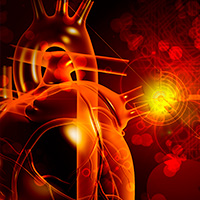 Effect of Preventive PCI for Non-Flow-Limiting Vulnerable Plaques in Patients With Diabetes: The PREVENT Trial