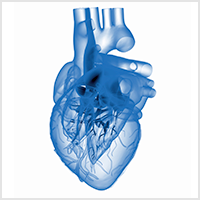 Outcomes of Orbital Atherectomy for Coronary Calcified Nodules