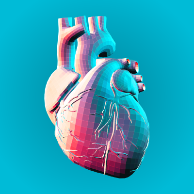 Intravascular Assessment After CTO-PCI Using OCT: The PERFECTO Study