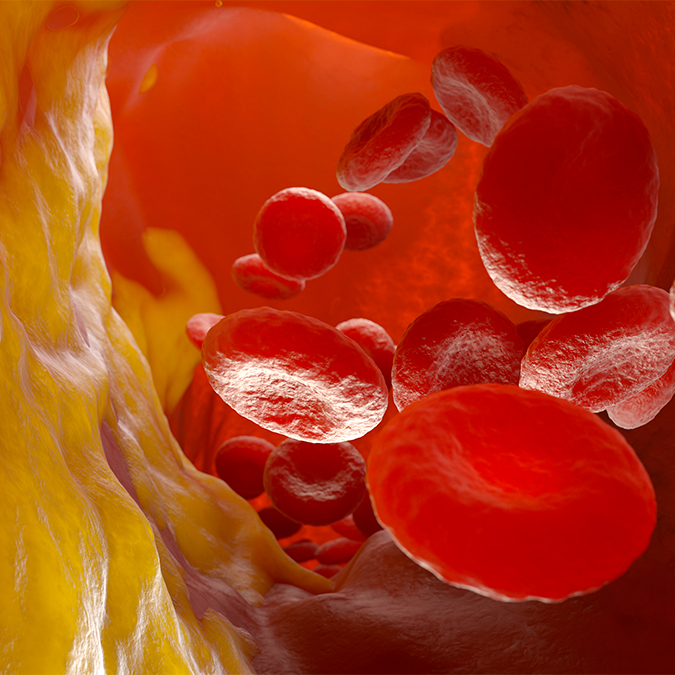 Aspirin-Free Strategy in High Bleeding Risk ACS and Non-ACS Patients Undergoing PCI: A Subgroup Analysis of the STOPDAPT-3 Trial